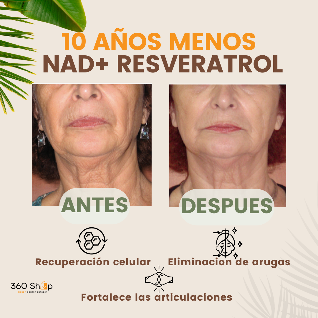 NAD  + RESVERATROL
